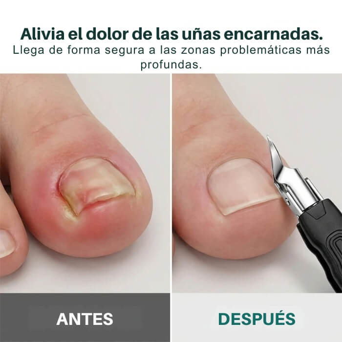 Set de Cortauñas Profesional de Pedicura