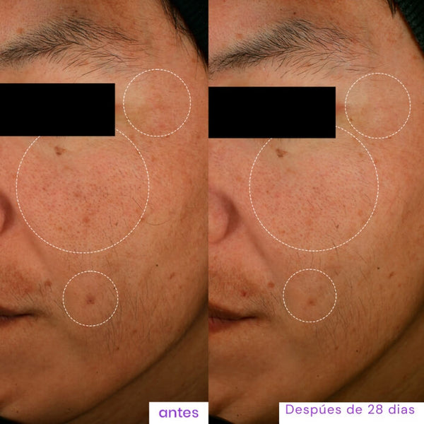 Niacinamida Super 20%